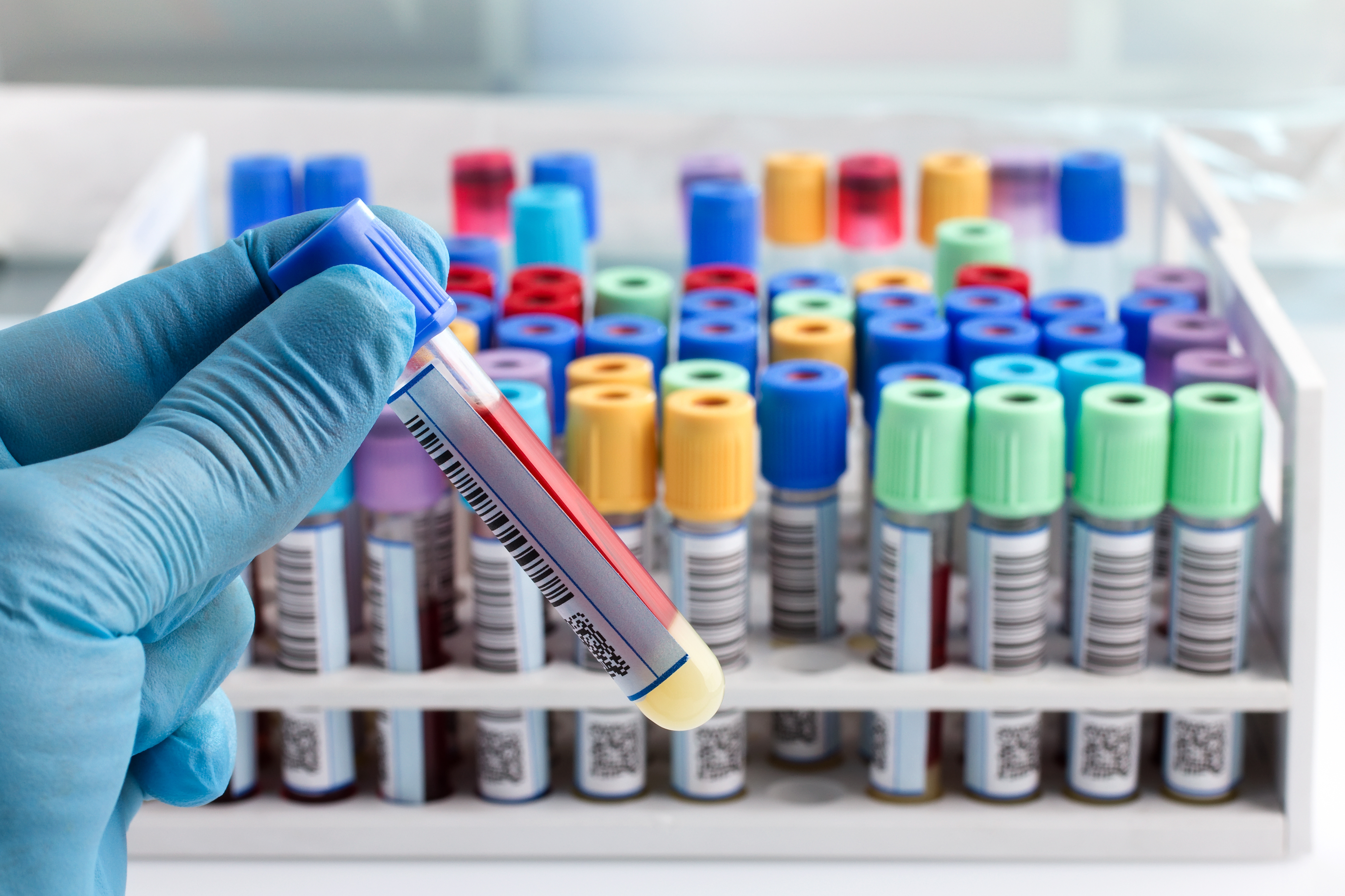 La banque biologique – Un investissement pour l’avenir